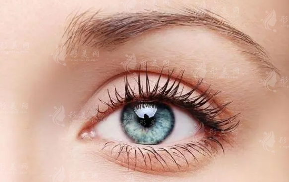 雙眼皮修復(fù)后為何會有難看的“肉條”？有瘢痕增生是失敗嗎？