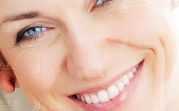 玻尿酸填充法令紋：詳細探討與解析