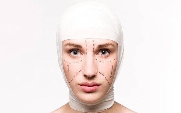 懸吊筋膜拉皮手術的價格與效果維持時間