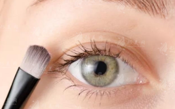 眼瞼松弛的原因及適合的手術(shù)方法