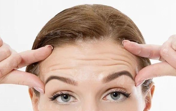 抬頭紋能否徹底去除？減輕抬頭紋的方法有哪些？
