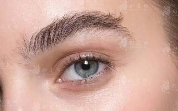 自體脂肪填充眉弓：吸收快慢的原因分析