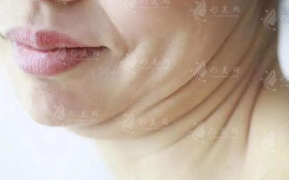 如何快速去雙下巴？去雙下巴的方法有哪些？