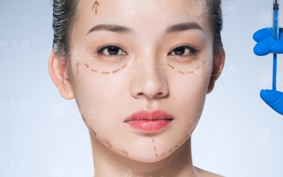 下頜角肥大與追求小V臉的手術(shù)選擇