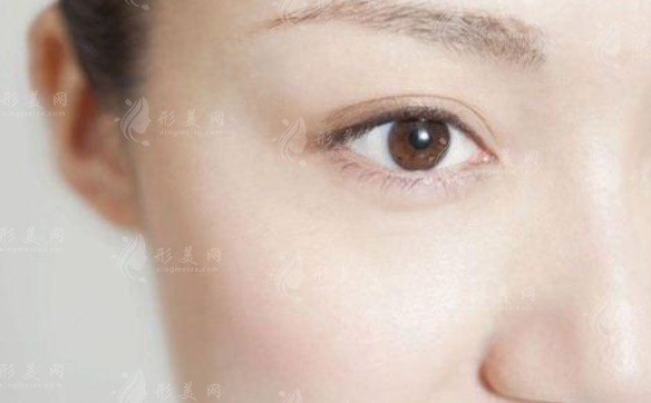 如何快速有效去除眼袋：了解常見(jiàn)眼袋類型及應(yīng)對(duì)方法