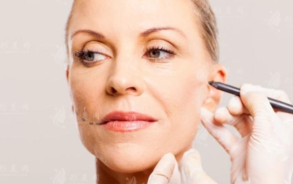 面部微創(chuàng)除皺方法及優(yōu)劣勢(shì)匯總 面部微創(chuàng)除皺方法及優(yōu)劣勢(shì)匯總