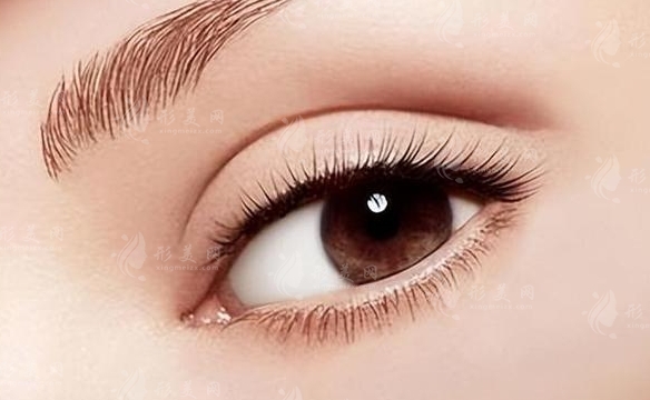 雙眼皮修復(fù)手術(shù)：難度遠(yuǎn)超初次手術(shù)的奧秘