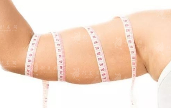 蝴蝶臂吸脂：價(jià)格與反彈問題全解析