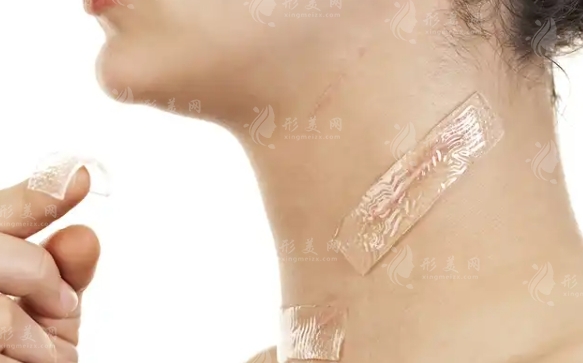 像素激光去疤：效果如何？收費貴嗎？