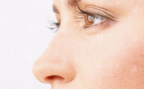 半肋鼻與全肋鼻：區(qū)別與選擇