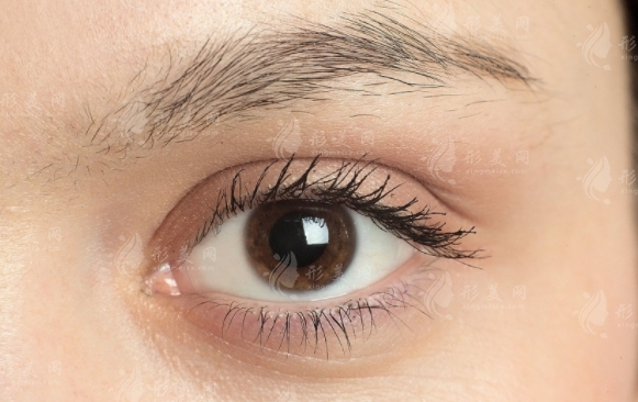 開(kāi)外眼角術(shù)價(jià)格一般是多少？影響價(jià)格的因素大盤點(diǎn)