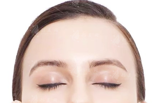 額部脂肪填充的效果能維持多久？