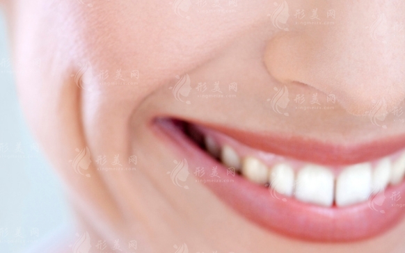 玻尿酸去除法令紋：效果與維持時(shí)間的探討