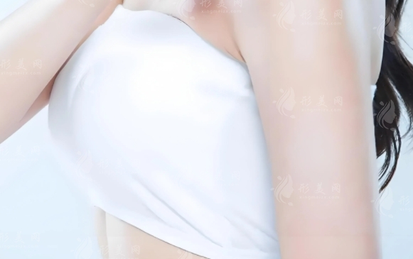 自體脂肪注射隆胸與假體隆胸：哪個好，手感如何？