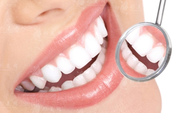 牙齒貼面：持久性與維護(hù)的全面解析