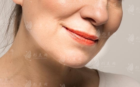 如何去除臉上的嘴角皺紋？多種方法助你重拾青春光彩