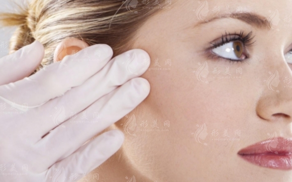 做自體脂肪豐太陽穴手術前應注意的事項