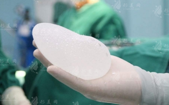 假體隆胸：切口位置與材料選擇