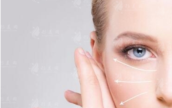 自體脂肪豐太陽穴：效果能維持多久？