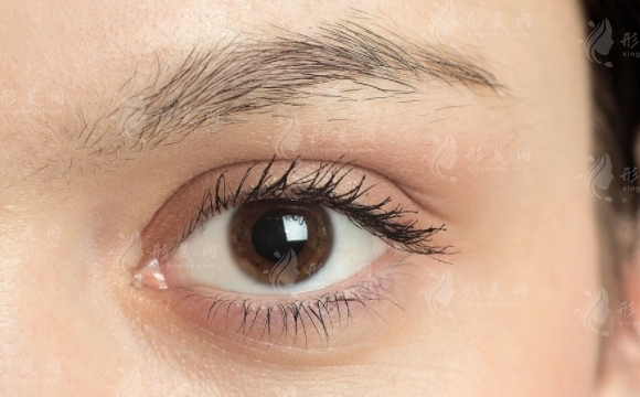 開(kāi)外眼角的有效方法有哪些？