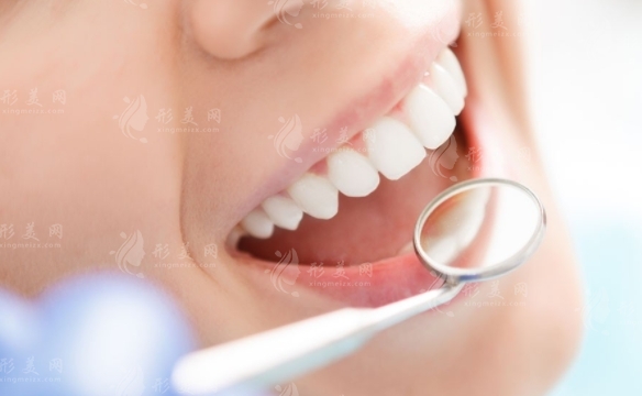 烤瓷牙的安裝過程詳解