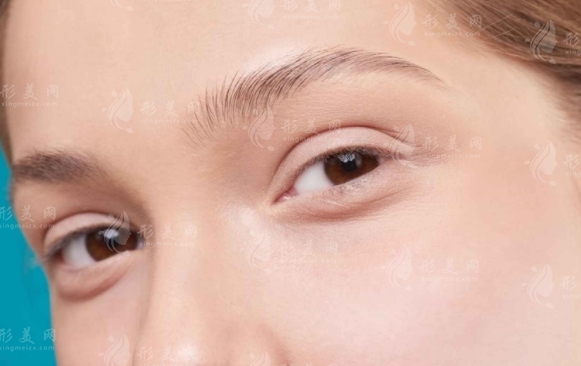 不開刀去眼袋靠譜嗎？調(diào)節(jié)方式有哪些？