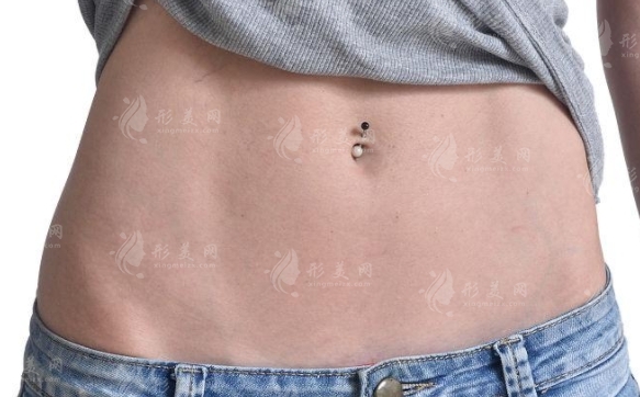 腹部除皺的方法有哪些？一起來看看吧！