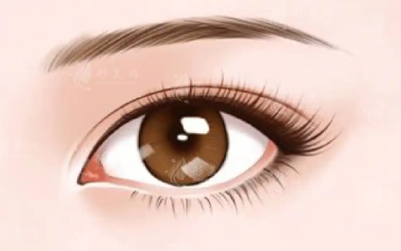 雙眼皮縫線法解析：效果是否永久？