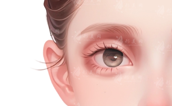眼窩凹陷：除了填充，還有哪些改善方法？