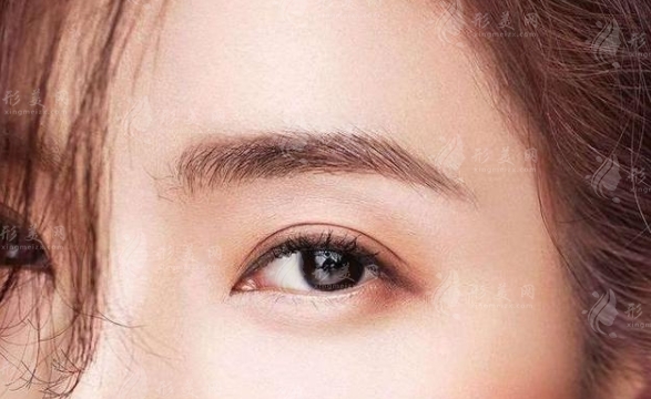 硅膠假體墊眉弓會移位嗎？如何預防？