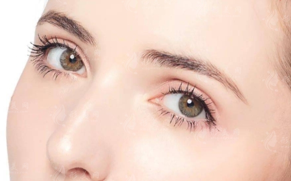 內(nèi)切眼袋手術解析：原理、恢復與復發(fā)探討