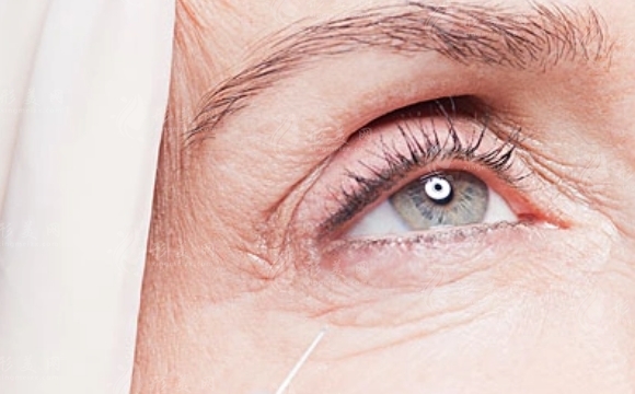 微針除皺：副作用與適用性分析