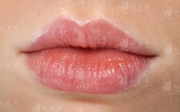 玻尿酸豐唇珠能維持多長時間？