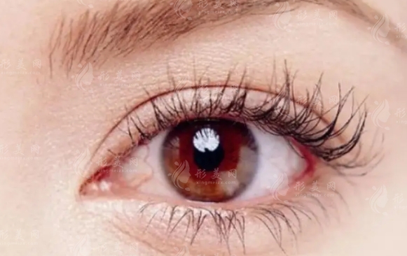 脂肪填充眉弓后眼睛凹陷的處理方法