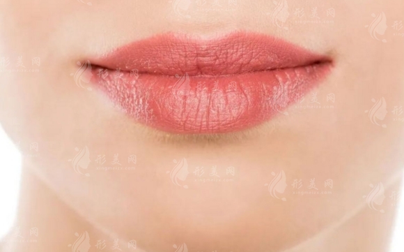 厚嘴唇變薄及其原因探析