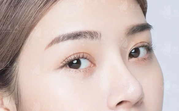 為什么很多人隆鼻多年后會(huì)塌陷？注意事項(xiàng)一覽