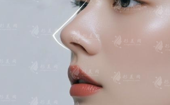 隆鼻手術(shù)后會(huì)面臨鼻頭攣縮的問(wèn)題嗎？