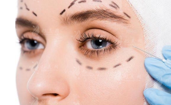 外切去眼袋會留下疤痕嗎？術后疤痕增生如何處理？