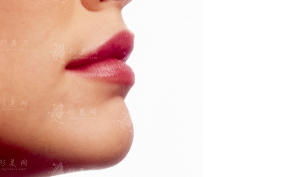 雙下巴溶脂：價(jià)格與副作用的深度解析