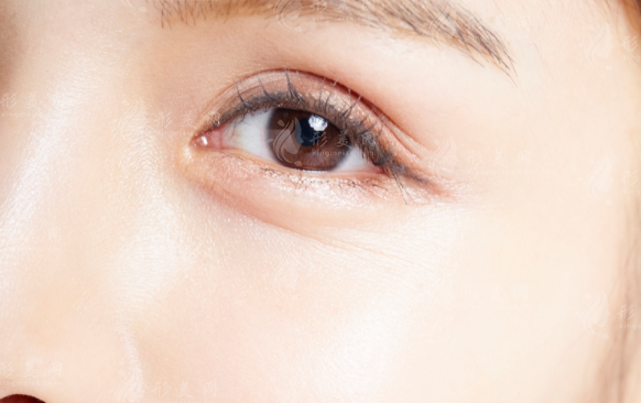 激光去眼袋：副作用、優(yōu)點及術后注意事項