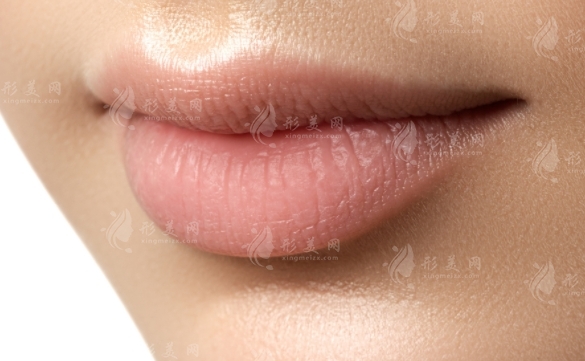厚唇改薄手術(shù)：恢復(fù)時間與手術(shù)風(fēng)險解析