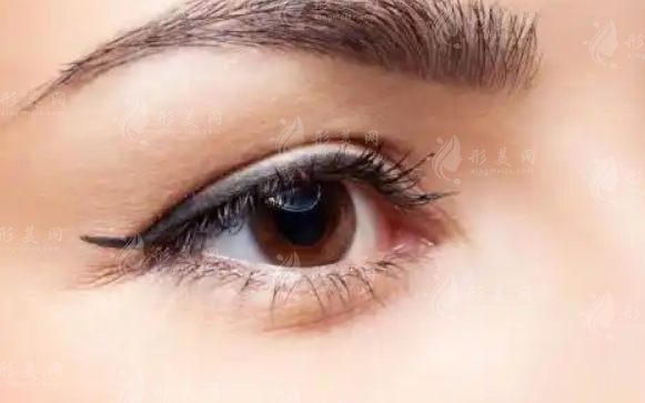 溶脂去眼袋：潛在風險與效果維持探討