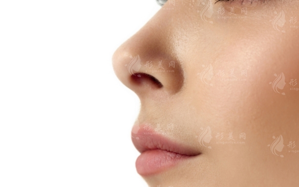 縮小鼻翼鼻頭手術(shù)費用及風險分析