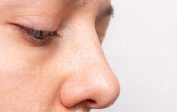 隆鼻手術(shù)失敗的癥狀及修復(fù)次數(shù)探討