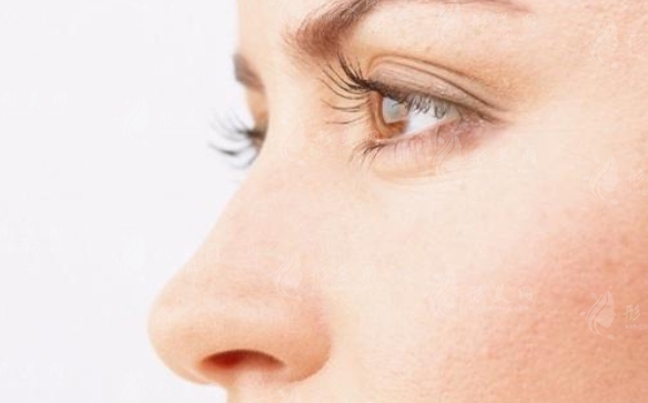 鼻綜合術(shù)后出現(xiàn)感染怎么辦？