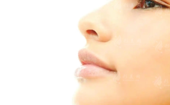  自體軟骨隆鼻術(shù)：受歡迎的隆鼻選擇及其顯著好處