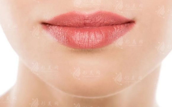 自體脂肪注射豐唇：價(jià)格與效果解析