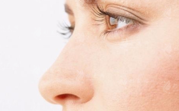 鼻子整形：假體與軟骨，哪種適合你？