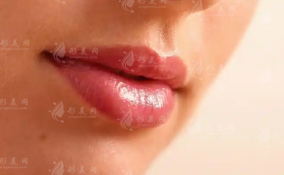 厚唇改薄：恢復(fù)時間與手術(shù)風(fēng)險全解析