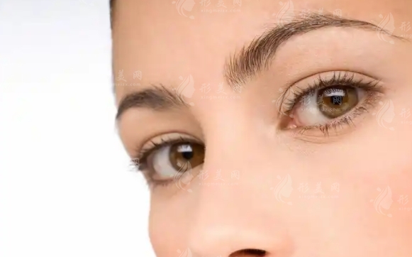 微創(chuàng)雙眼皮：長期效果與潛在弊端